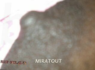 MIRATOUT Blog éjac
