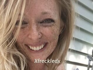 Xfreckledx